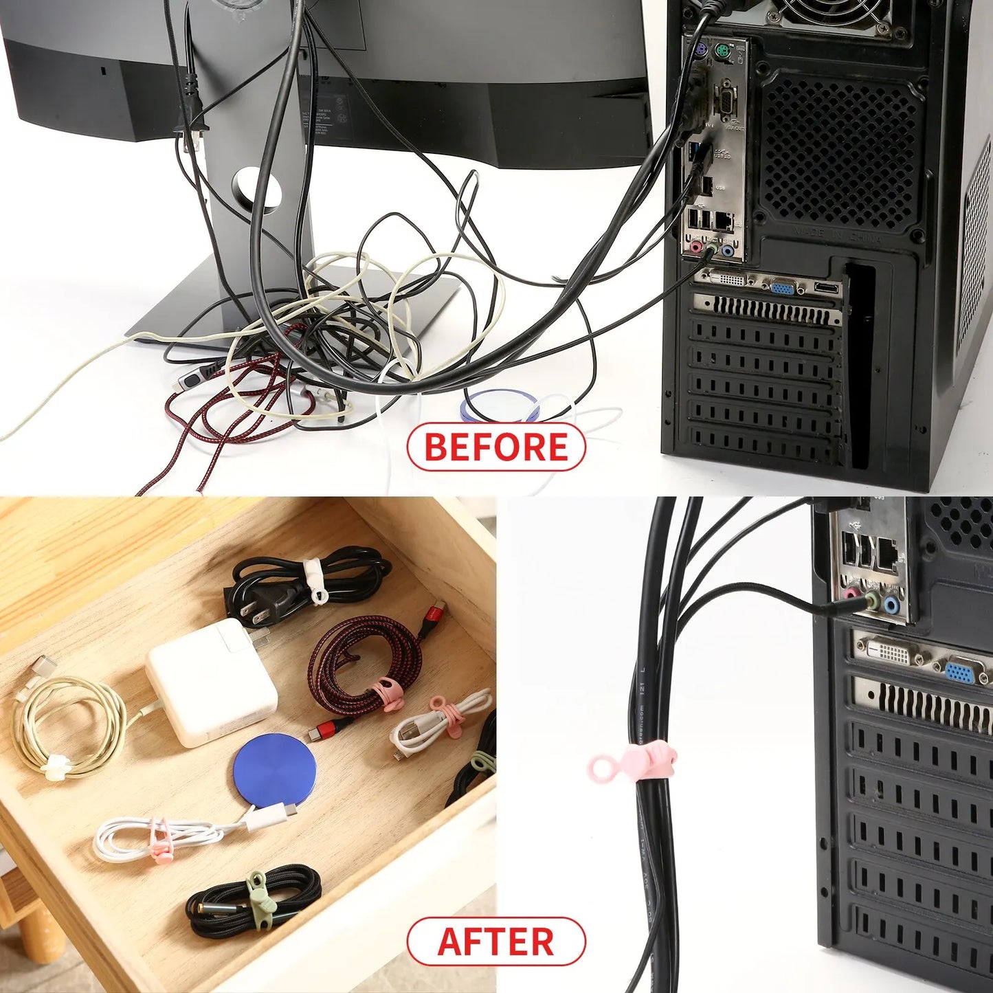 FlexLoop Cable Tie Set